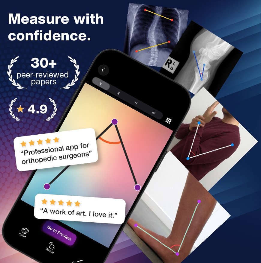 Angulus app measuring joint, postural, and radiographic angles — used in peer-reviewed research and highly rated by clinicians